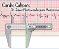 Cardio Calipers Screenshot 0