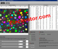 Pixcavator Image Analysis Software Screenshot 0
